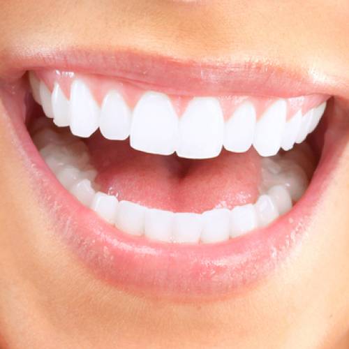 Los efectos secundarios asociados con el uso de resinas para odontología