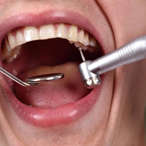 Cómo las fresas dentales garantizan el éxito en los tratamientos odontológicos